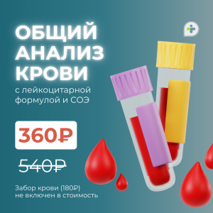 ОБЩИЙ АНАЛИЗ КРОВИ ЗА 360₽ ВМЕСТО 540₽