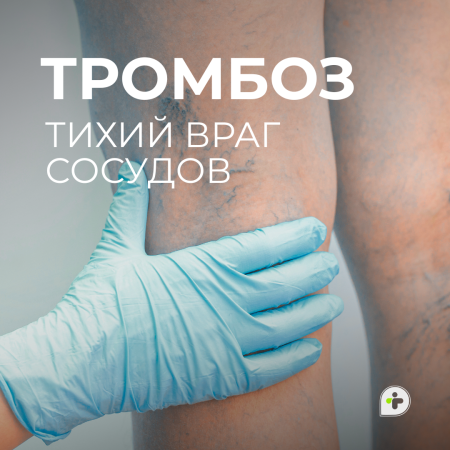 ТРОМБОЗ — ТИХИЙ ВРАГ ВАШЕГО ОРГАНИЗМА