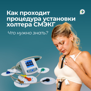 Как проходит процедура установки холтера СМЭКГ: что нужно знать
